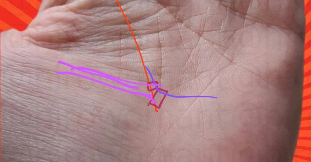 БОЛЬНИЧНАЯ ПАЛАТА 🏥