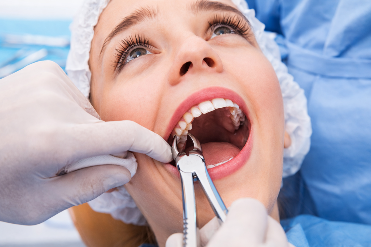 Удаление зуба