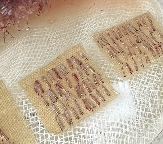 Изображение: сортировка графтов