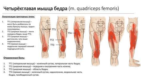 на изображении показаны причины боли в мышцах бедра