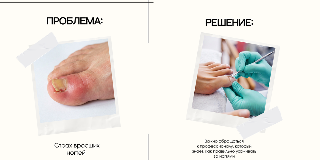 Ваши ноги просят о помощи: 5 сигналов, что пора записаться на педикюр в 21.13