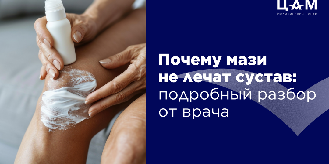 Почему мази не лечат сустав: подробный разбор от врача.
