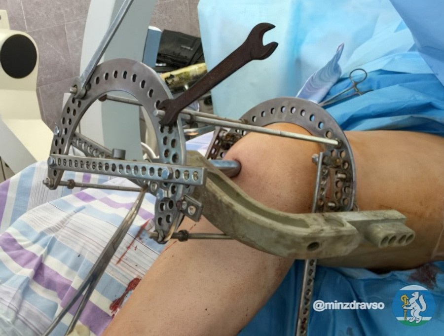     Фото: Свердловское министерство здравоохранения