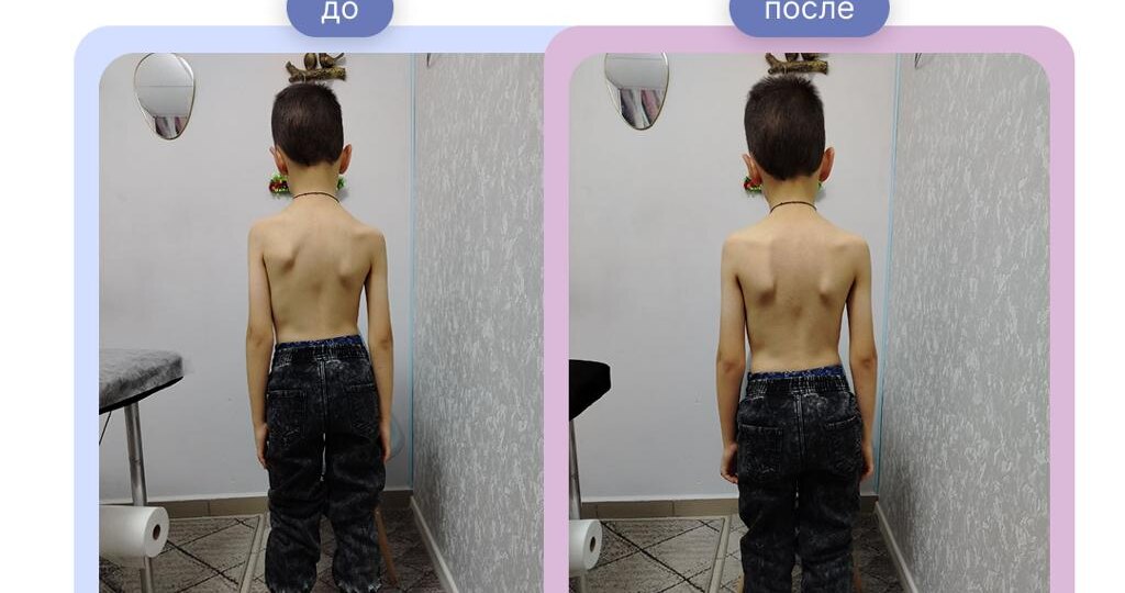 Клинический случай: один сеанс – и ноги больше не болят