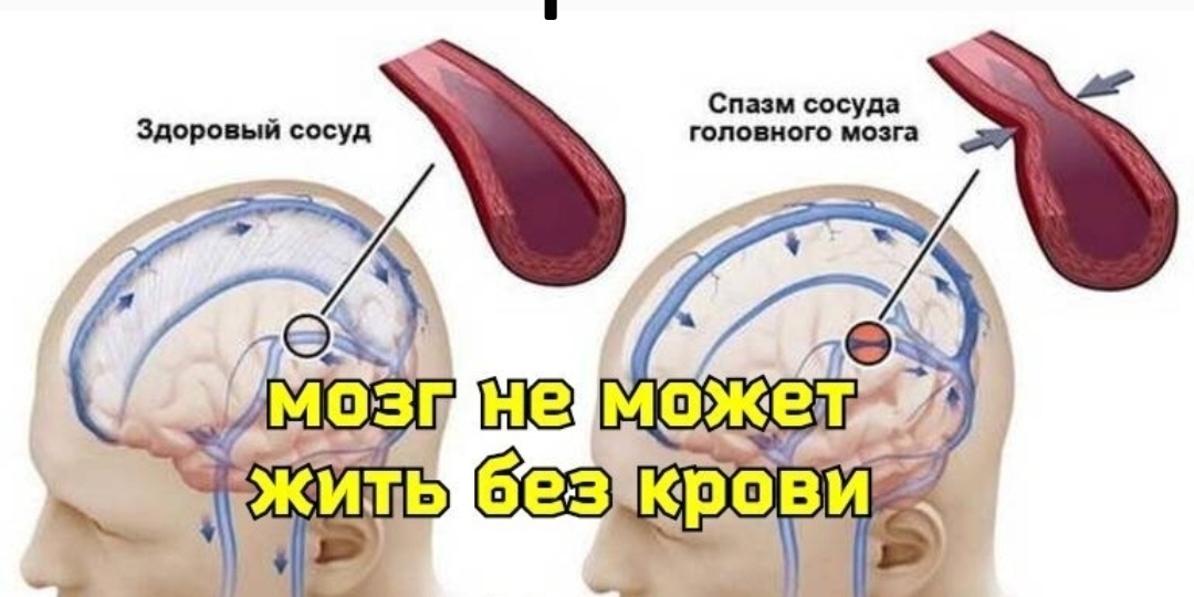 Мозг деградирует, когда сдавливается носоглазной анастомоз. Методы декомпрессии