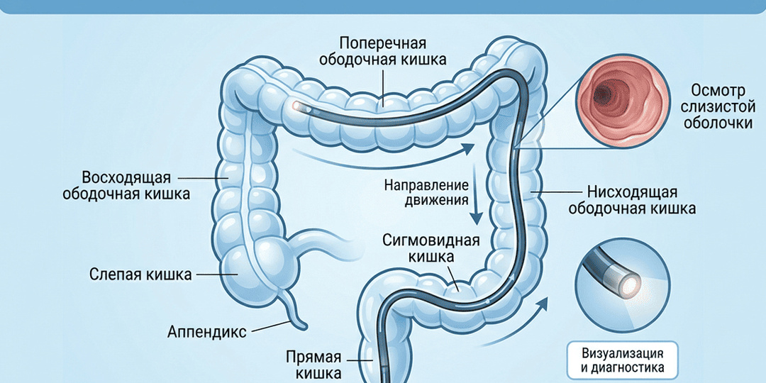 ЭНДОСКОПИЯ ПРИ ЯЗВЕННОМ КОЛИТЕ / Всё, Что Вы Хотели Спросить