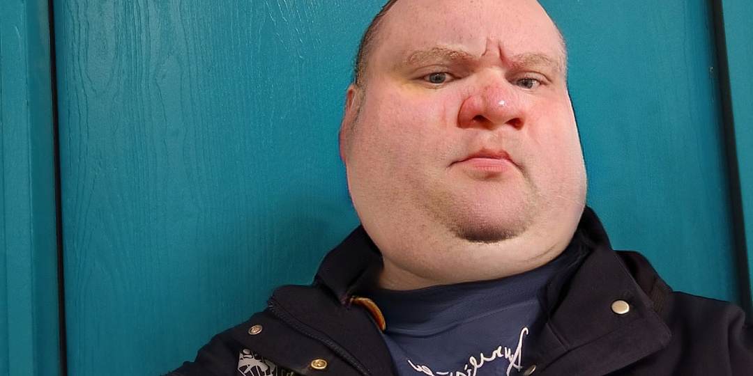 48 лет. Инсульт. И всё. Почему русские мужики не доживают до пенсии