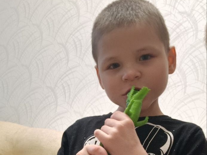 Подопечный БФ БлаговДар Сахапов Карим, 7 лет. Синдром Веста
