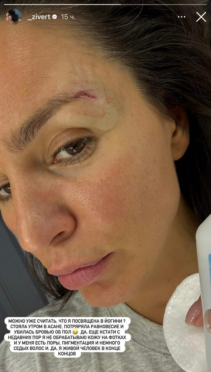    Zivert. Фото: Инстаграм (запрещен в РФ) @_zivert