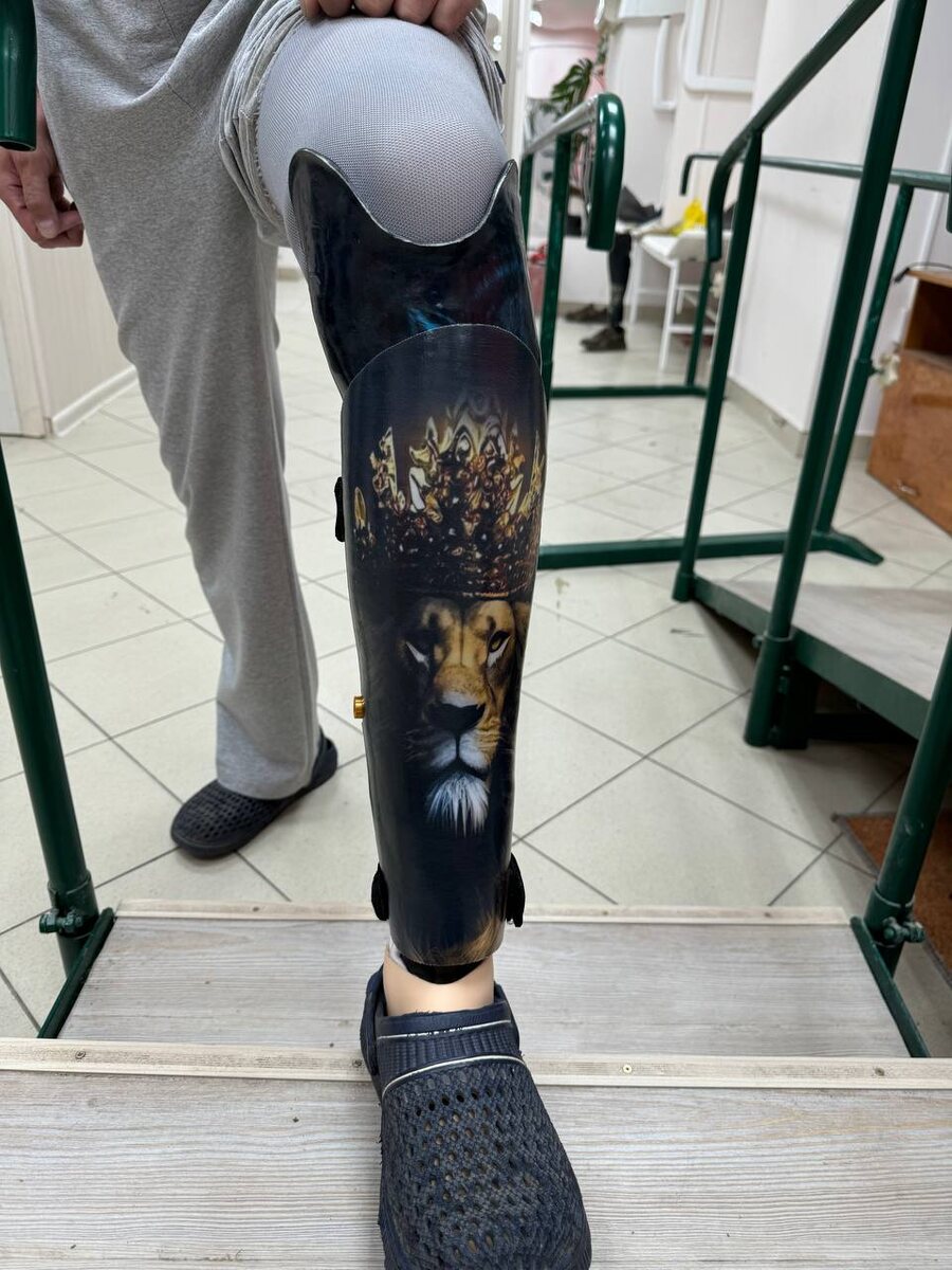 Протез голени модульный с индивидуальным принтом