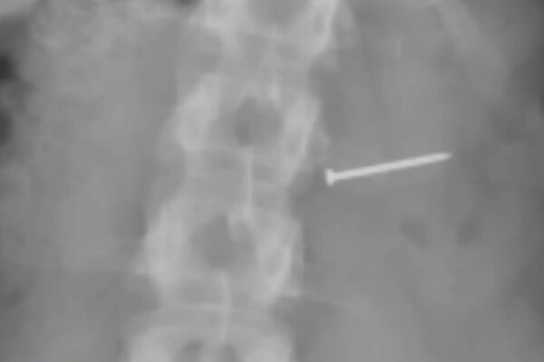 соцсети   📷