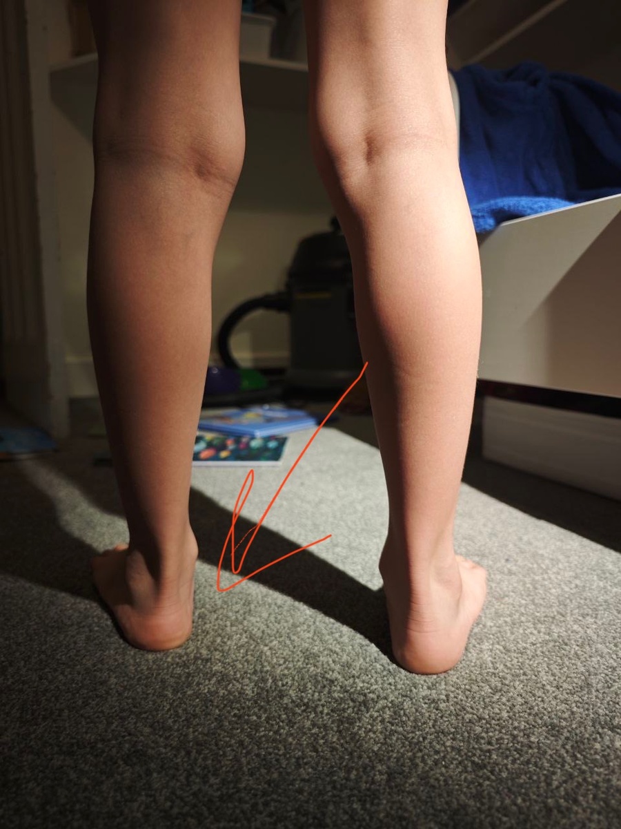 Фото пациента 6 лет