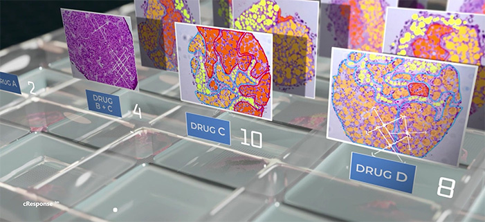 Рак под микроскопом: Почему израильские ученые не убивают опухоль, а холят и лелеют её