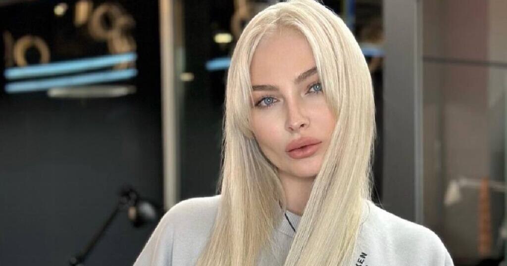 Поклонники обеспокоены состоянием Алены Шишковой