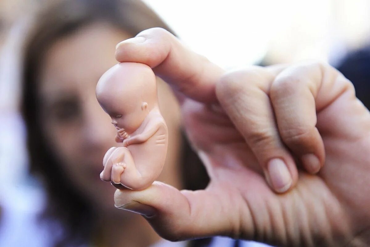 Фото с сайта: https://mywishings.com/abortion-essay/