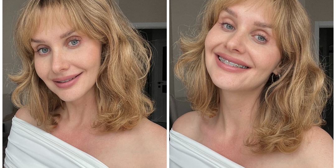 Хотела бы я знать об этом раньше: топ-5 полезных привычек, за которые меня похвалили стоматологи