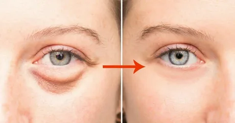 О здоровье по лицу: о чём вам расскажут мешки под глазами