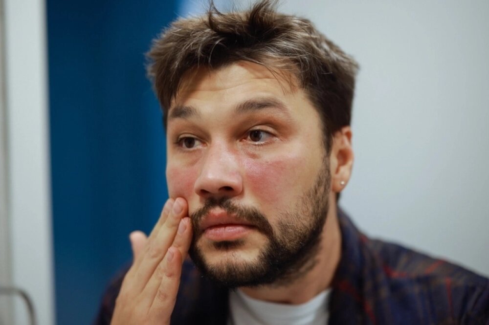    Румяная щека является символом жизненной энергии, радости или смущения. Фото: istockphoto.com