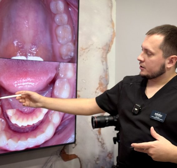 Что делать, если на верхней челюсти вообще не осталось зубов. Разбираем все варианты помимо съемных протезов