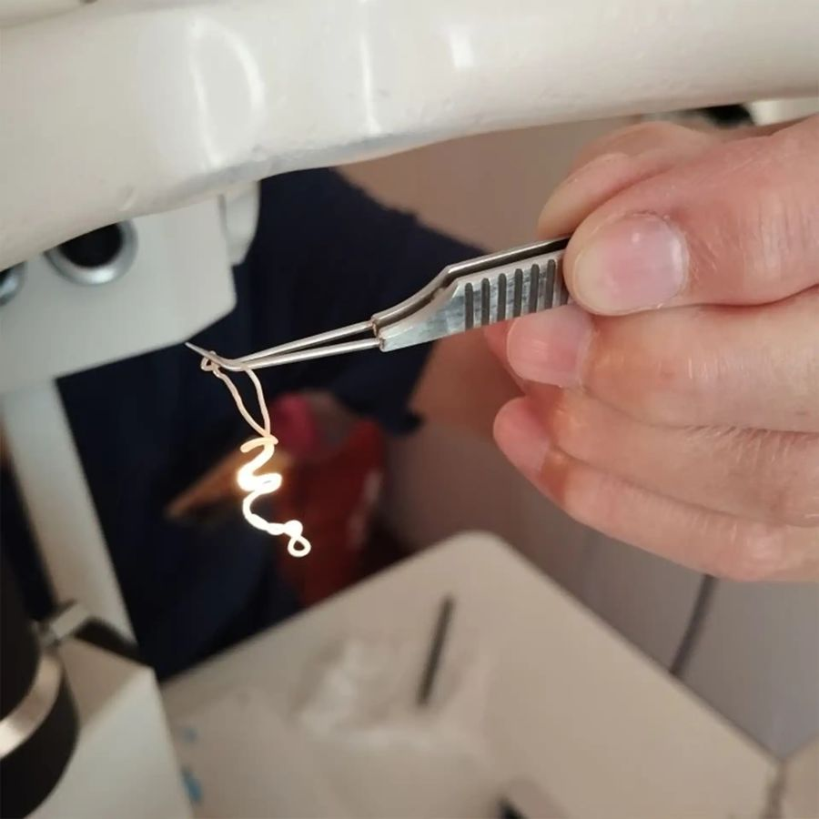 Круглый червь, извлечённый из глазного яблока пациента.