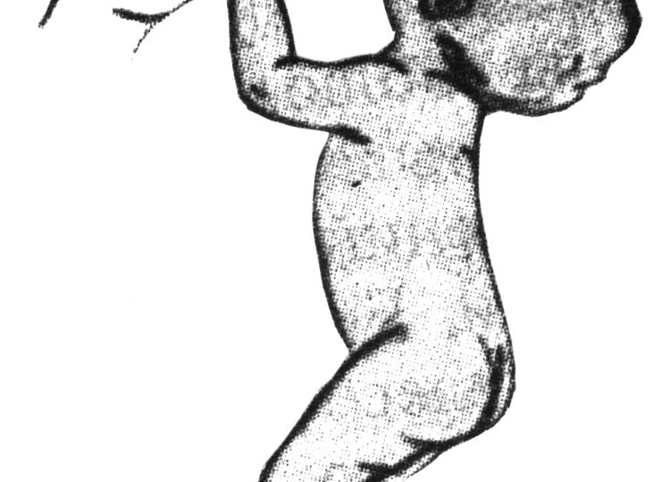 Хватательный (обезьяний) рефлекс у новорожденных.