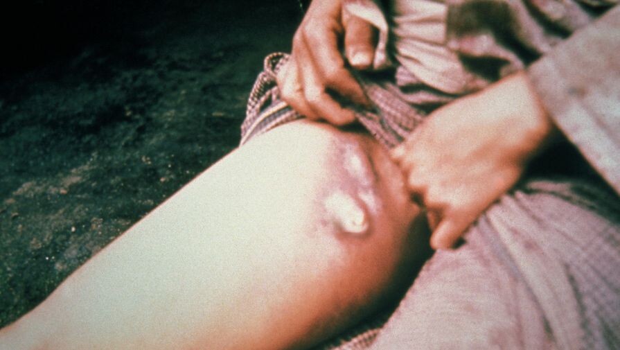 wikipedia.org   📷