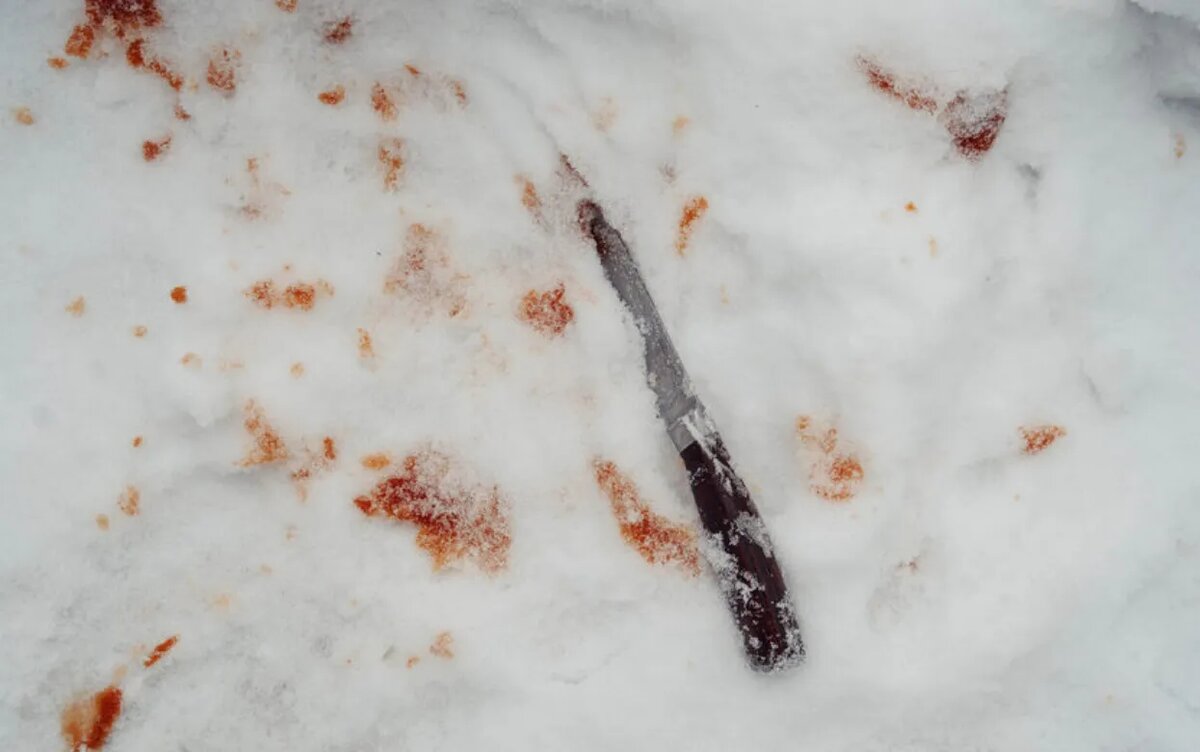    Житель Удмуртии 10 раз ударил знакомую ножом