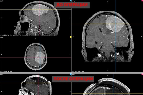 НМИЦ им. ак. Е.Н. Мешалкина Минздрава России/VK   📷