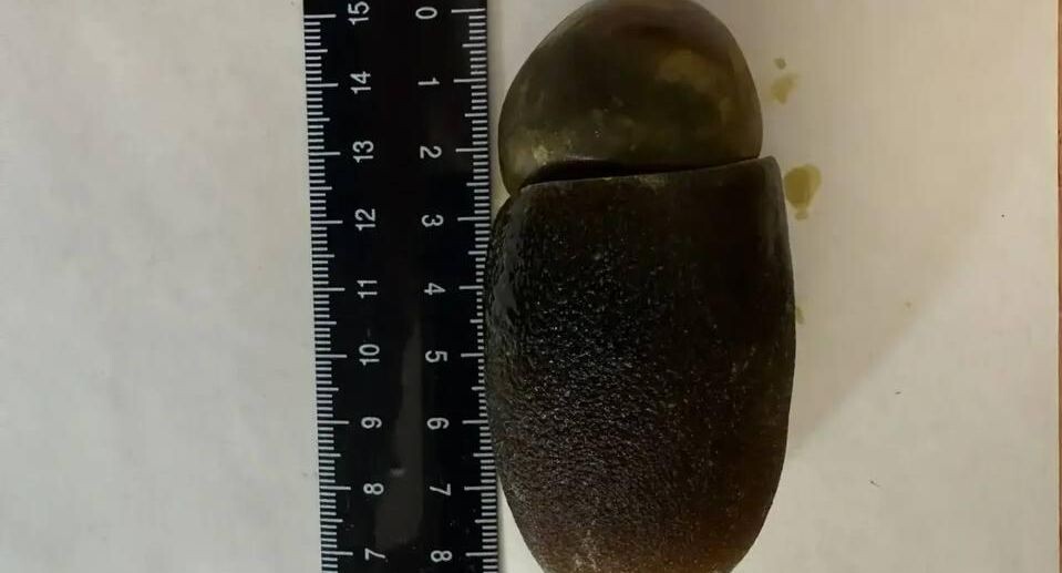    Коломенская больница