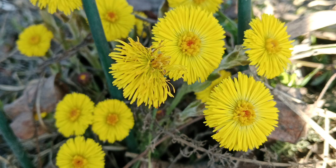 Операция "гиппокамп", или как я пришивала мужику мозги от скуки