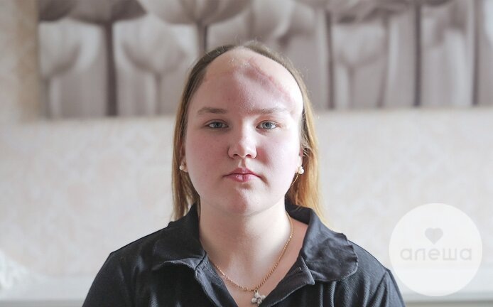 «Собака держала в пасти её длинные волосы и продолжала их трепать»: как шестилетняя Ксения выжила после нападения собаки