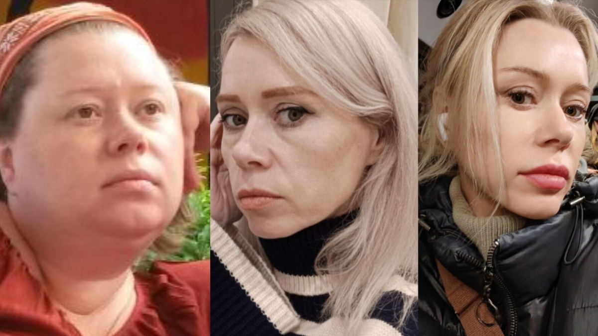 До похудения (35), после похудения (44), после подтяжки лица (45)