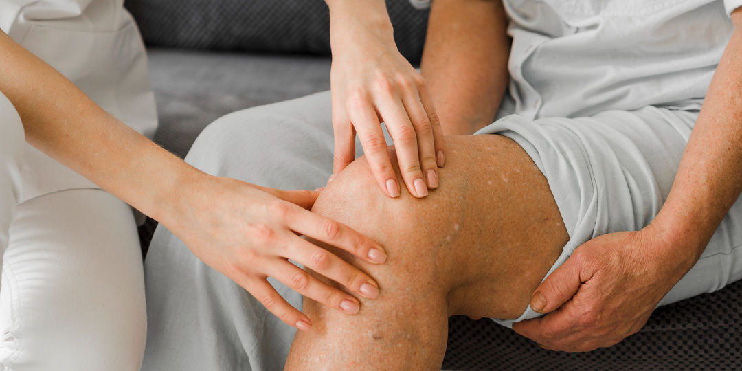 Варикоз после 35: почему появляется и как его видно на ногах до похода к флебологу