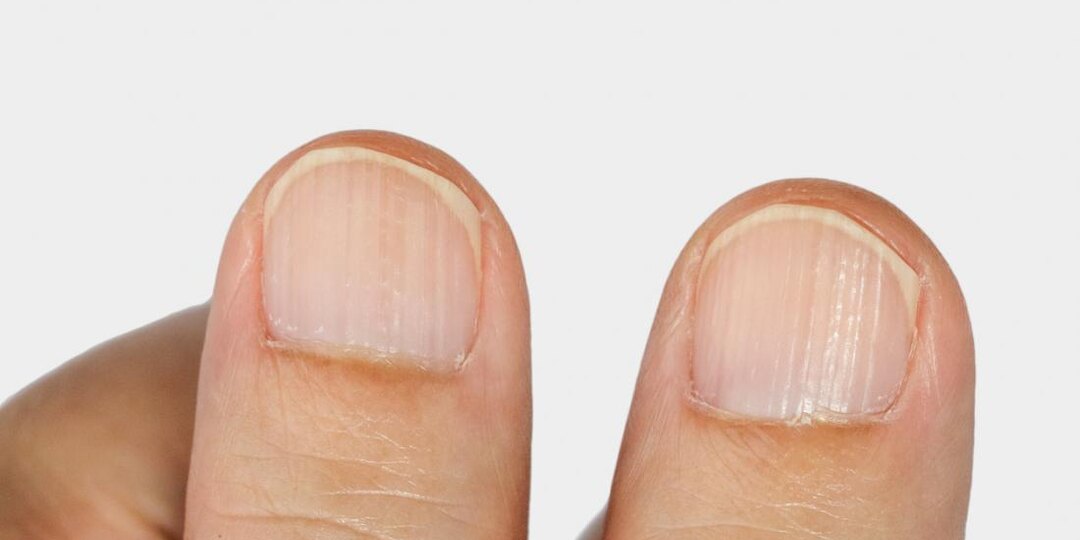 Этот симптом многие считают безобидным — а он может быть сигналом