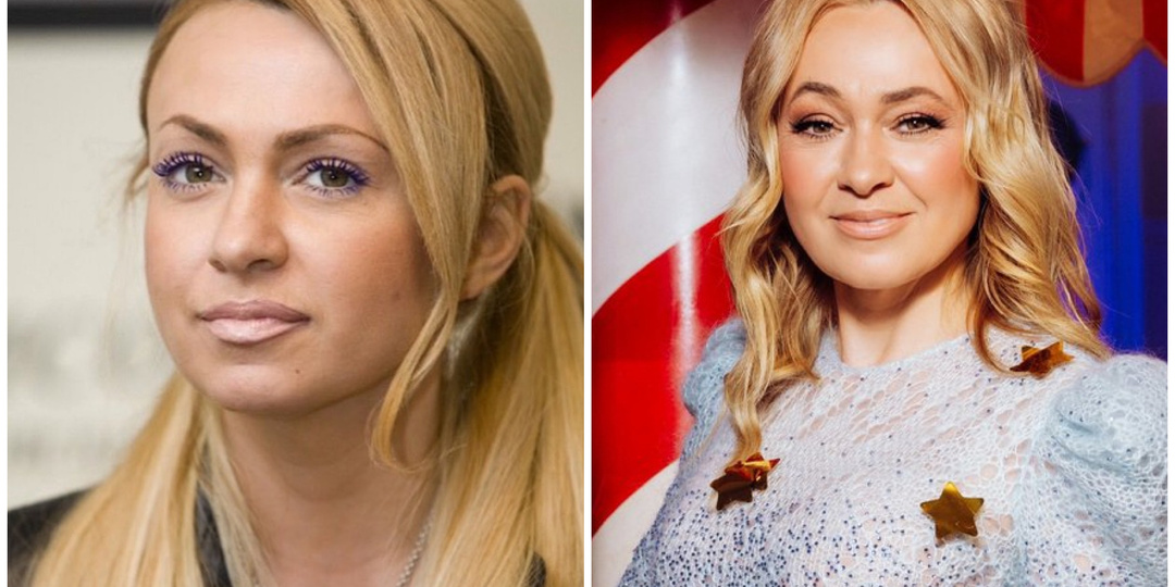 Тогда и сейчас: 11 старых фото наших знаменитостей из нулевых