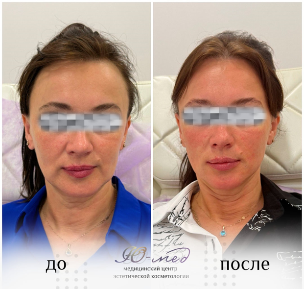 Работа врача-косметолога Яковенко Юлии Викторовны