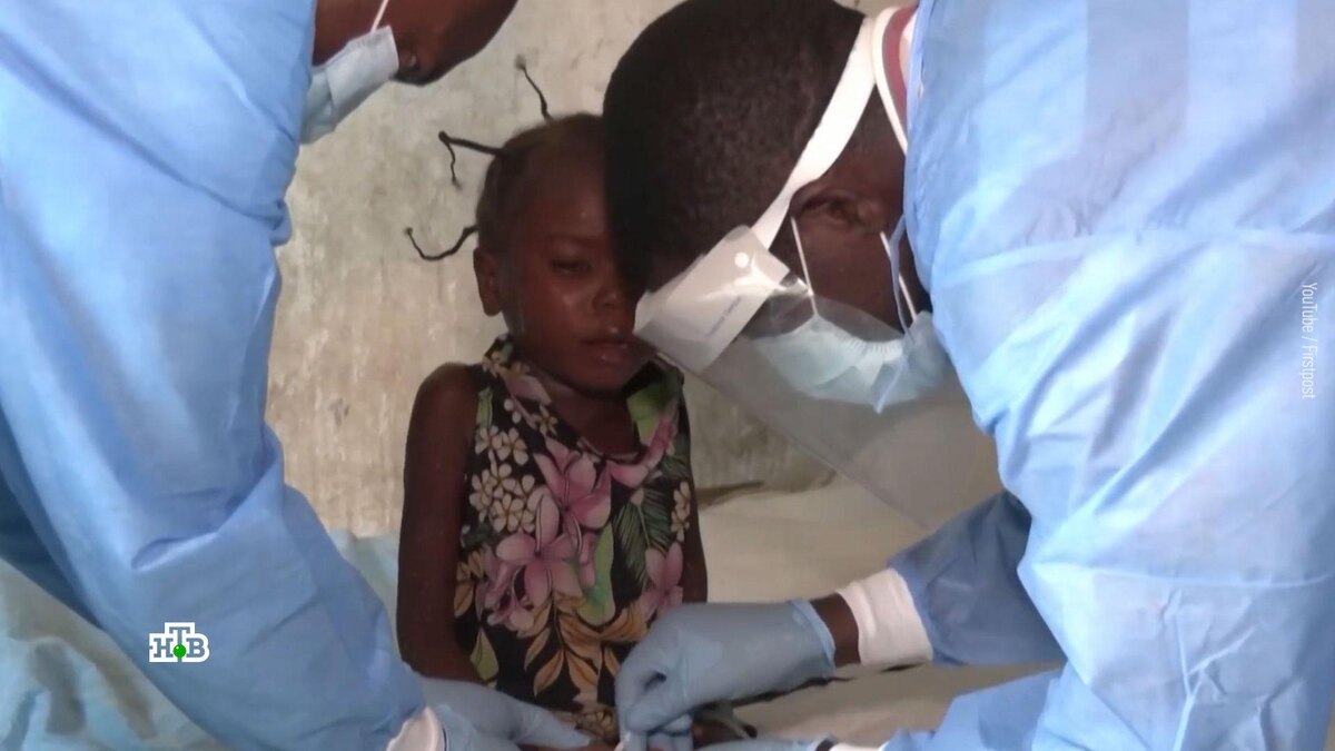    Оспа обезьян: насколько она опасна и кому выгодна новая пандемия