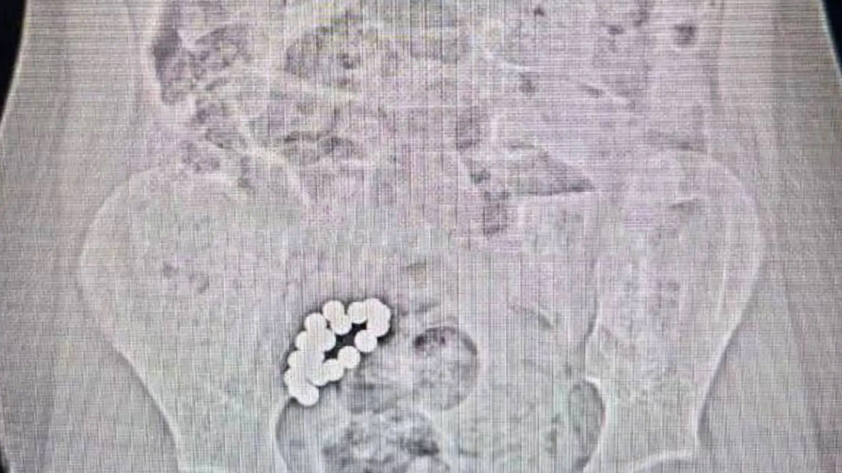    Первый канал