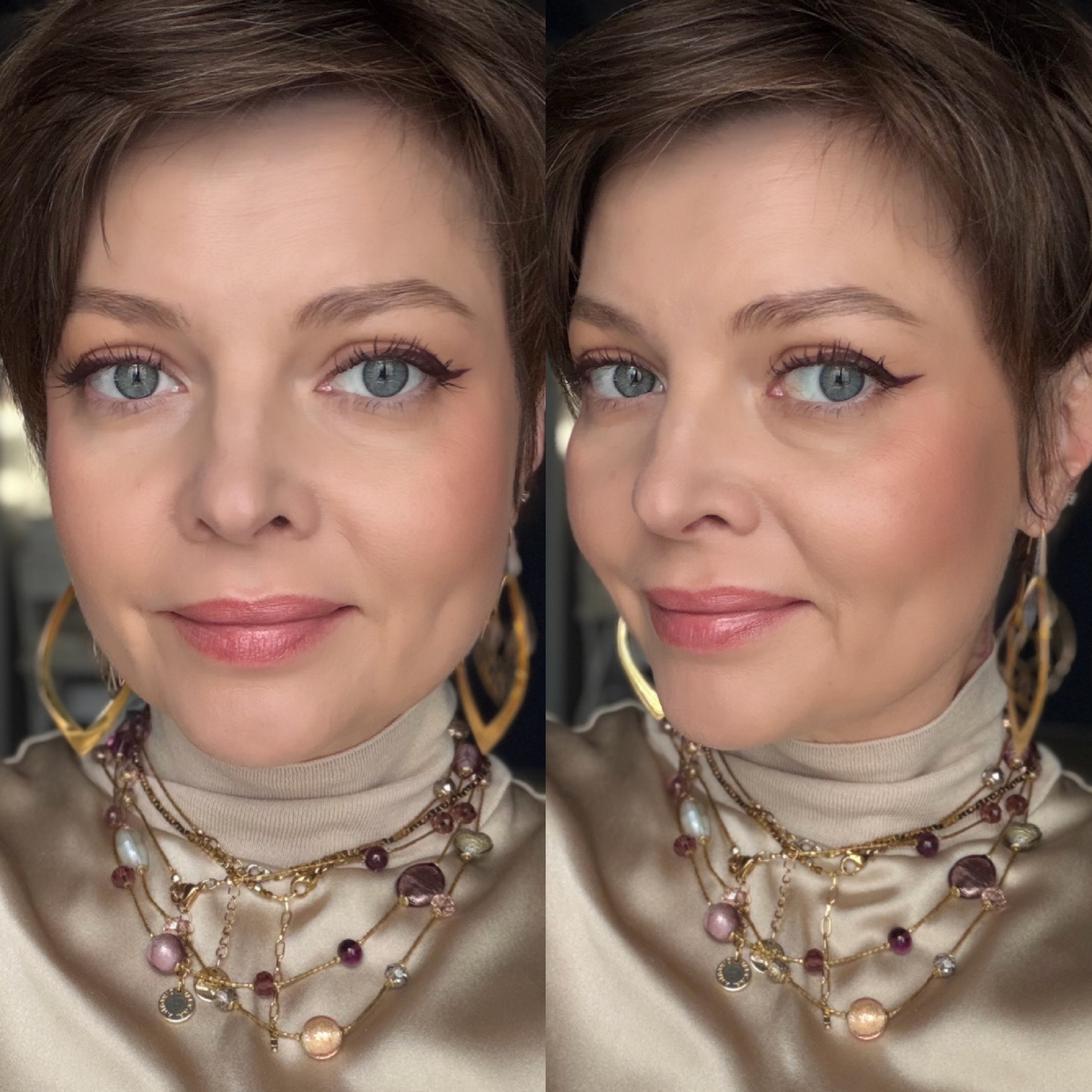 При свете прямо в лицо, никаких кругов под глазами у меня нет, появляются они при повороте головы