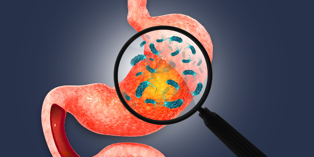 Соль, алкоголь, генетика и онкогенные бактерии