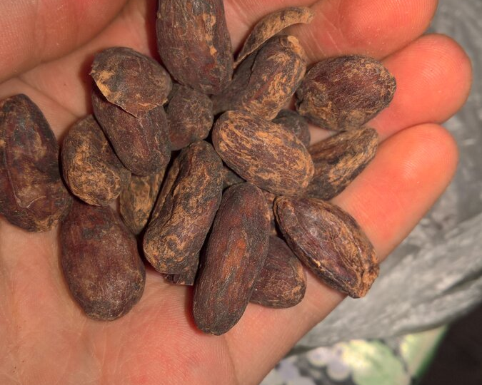 5 скрытых признаков, что печень уже работает хуже (многие их игнорируют)