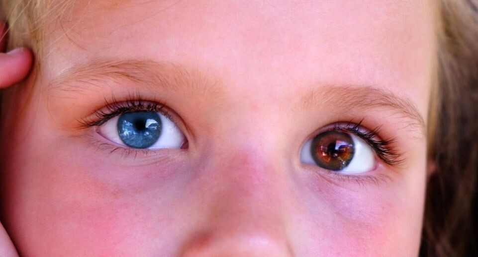    istockphoto.com/Elena Kurkutova