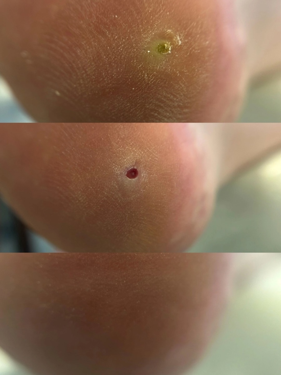 Работа нашего подолога Беловой Марии Анатольевны