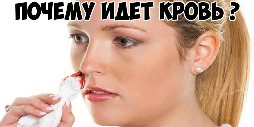 Почему течет кровь из носа?
