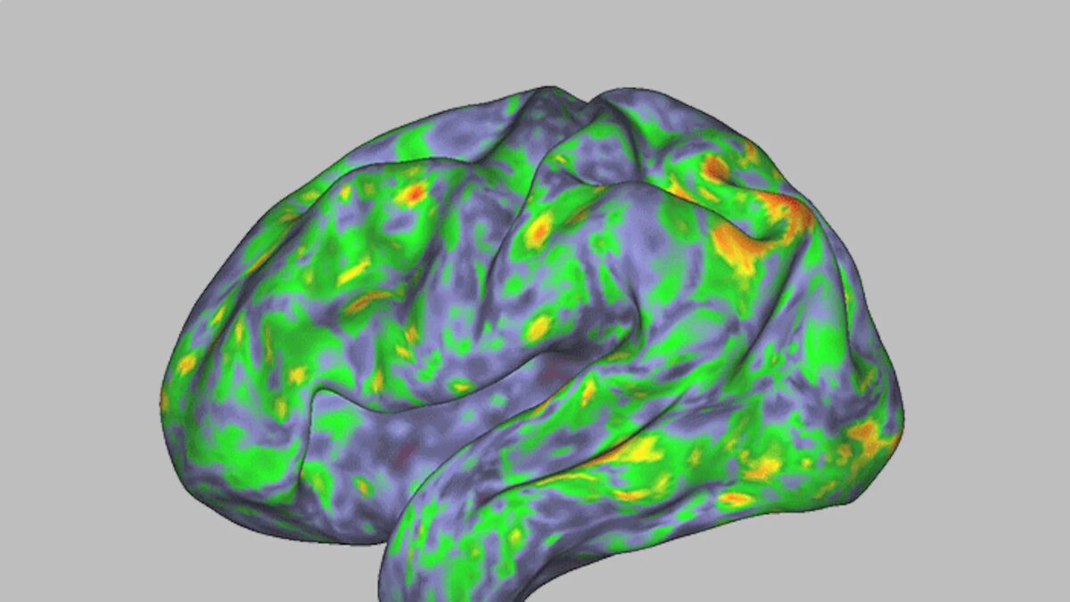 Психобиотики: новая “еда для мозга”, о которой вы не знали (а зря)