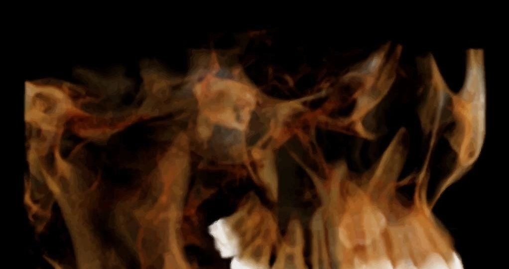 💎КЛИНИЧЕСКИЙ СЛУЧАЙ