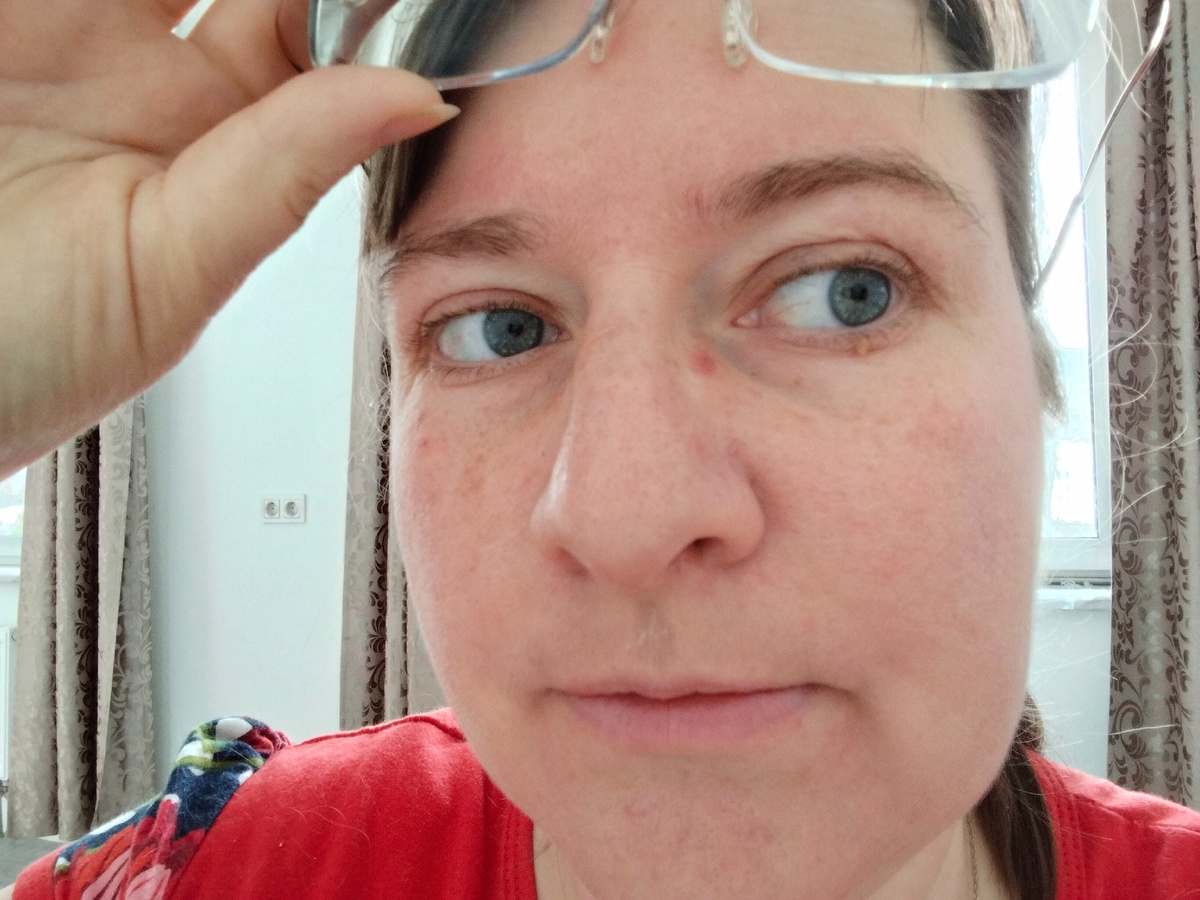 Очки натирают нос