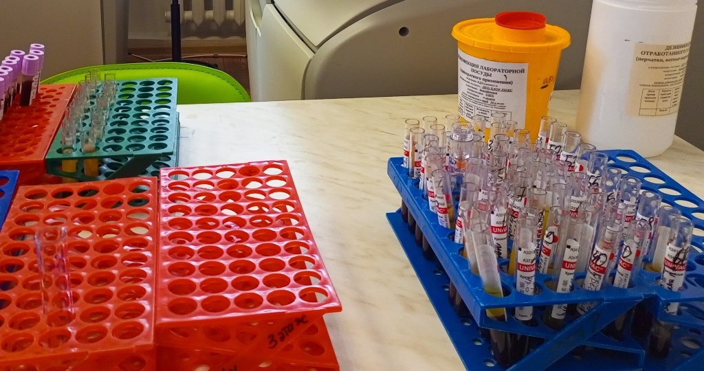 Больше возможностей для лечения пациентов от гепатита С появилось в Новосибирской области