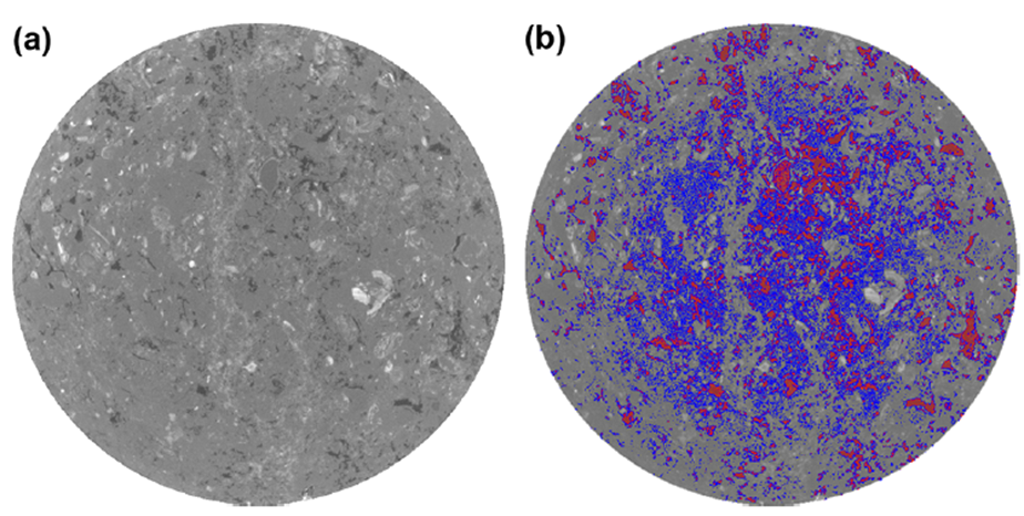 Сегментация КТ-изображения