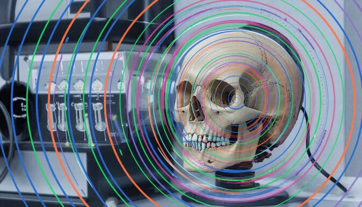    Программное обеспечение VitalID анализирует мельчайшие вибрации, которые распространяются через череп и мягкие ткани лица.